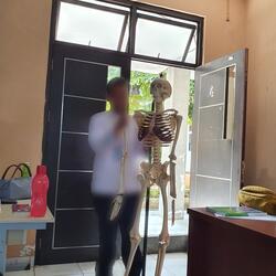 tulang rusuk gw dicabut dan organ gw ditarik perlahan - lahan