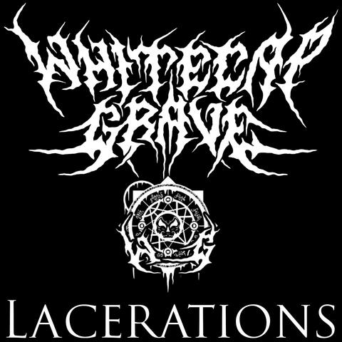 Lacerations