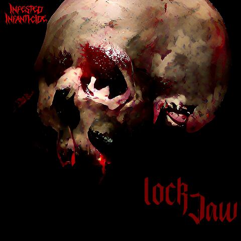 LockJaw