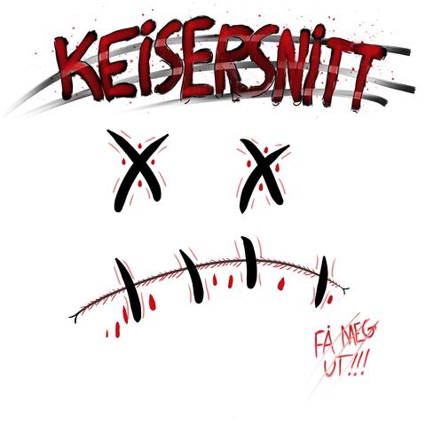 KEISERSNITT