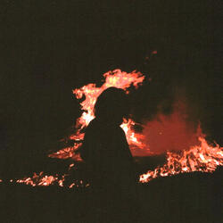 U Put Ur Cigarette Out On My Face it Hurt...