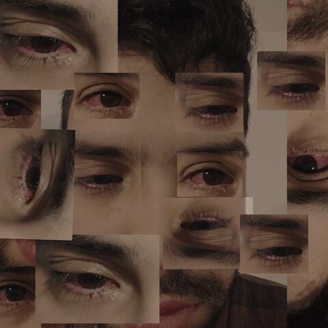 No rascarse el ojo