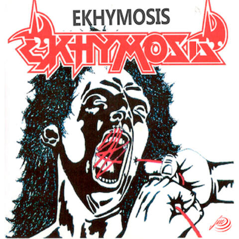 Ekhymosis