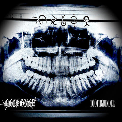 Toothgrinder