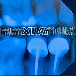 X Ray