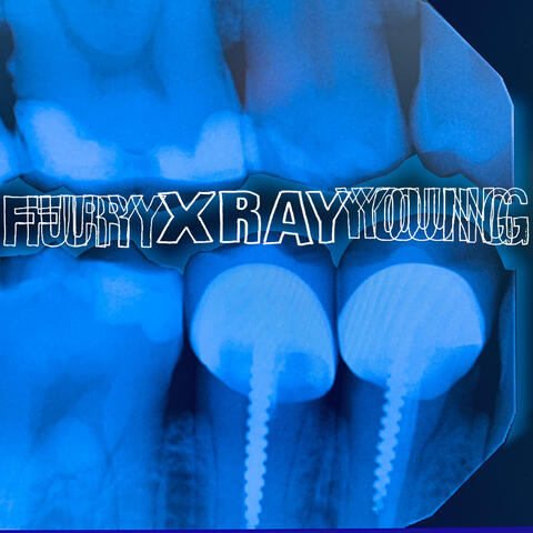 X Ray