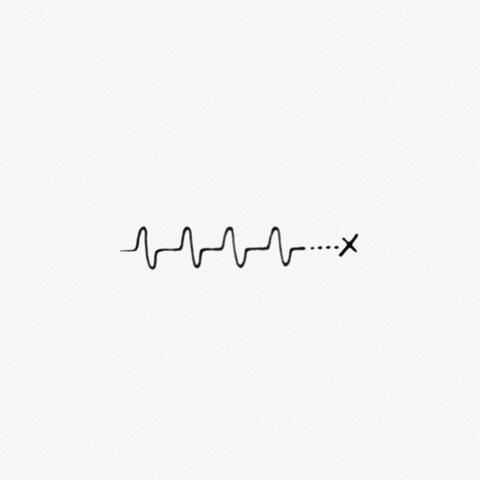 no pulse