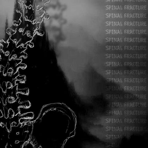 spinal Fracture