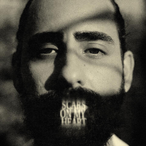 Scars On My Heart