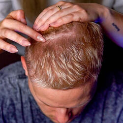 Satisfying Scalp Itching with Sharp Nails