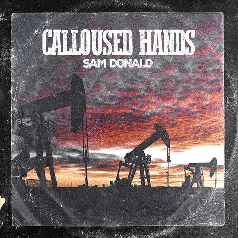 Calloused Hands