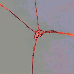 Fractures