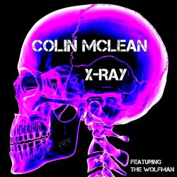 X-Ray