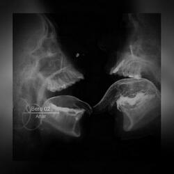 BERO 02 - Ultra Slowed