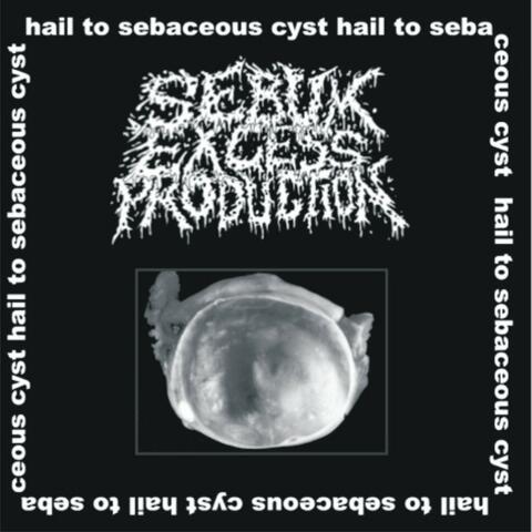 Hail To Sebaceous Cyst!