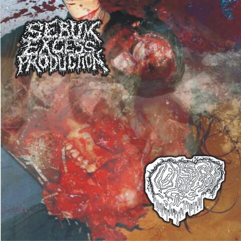 Tracks Off Split W/ Fetal Deformity