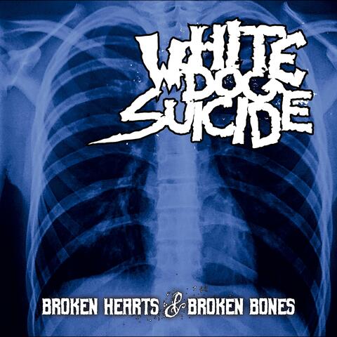 Broken Hearts & Broken Bones