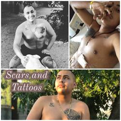 Scars and Tattoos