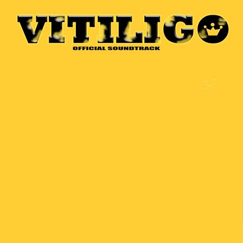 Vitiligo (Original Motion Picture Soundtrack)