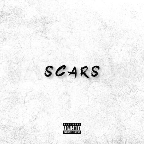 Scars