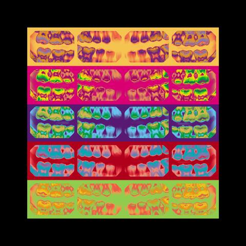 Cavity