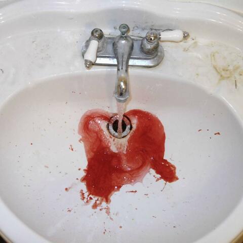 Vibration Karate, Vol. II