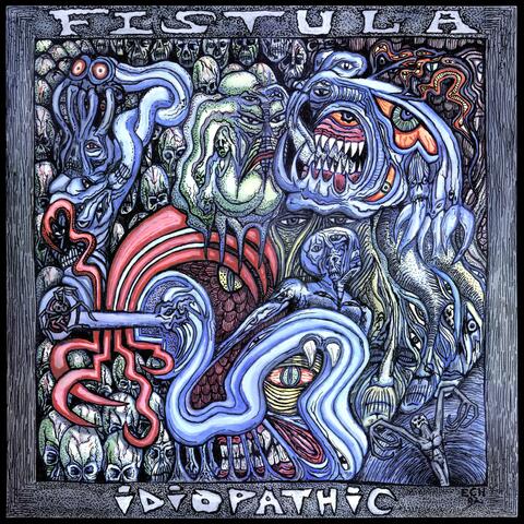 Idiopathic