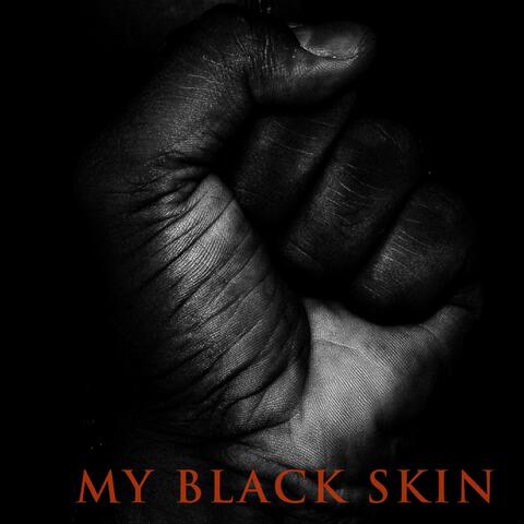 My Black Skin