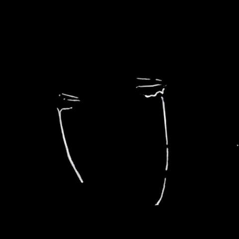 Sad X Emotional Beat (Crying in the Rain)