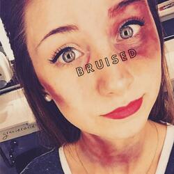 bruised
