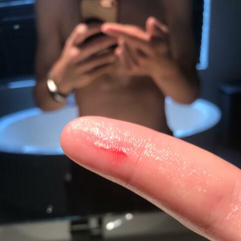it kinda hurts >_<