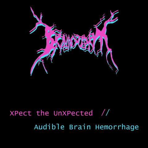 Xpect the Unxpected // Audible Brain Hemorrhage