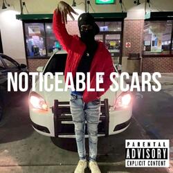 Noticeable Scars
