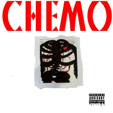 Chemo