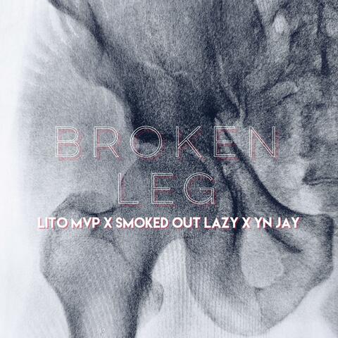 Broken Leg (feat. Smoked Out Lazy & Yn Jay)