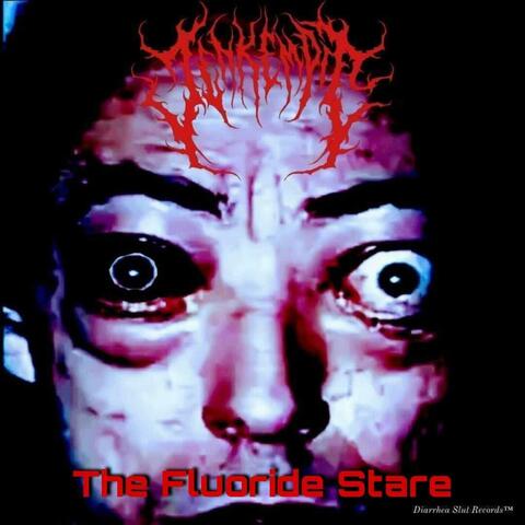 The Fluoride Stare