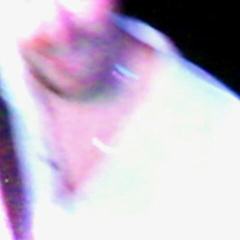 In Extremis