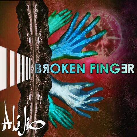 Broken Finger