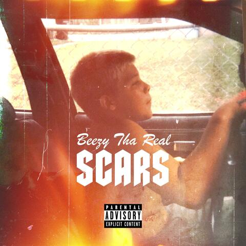 Scars