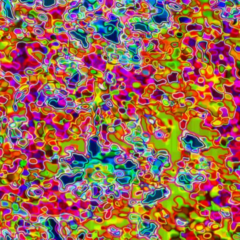 Neuroplasticity