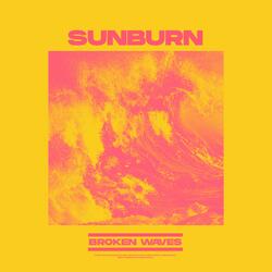 Sunburn