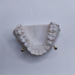 A Fragile Jaw