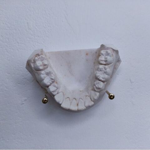 A Fragile Jaw