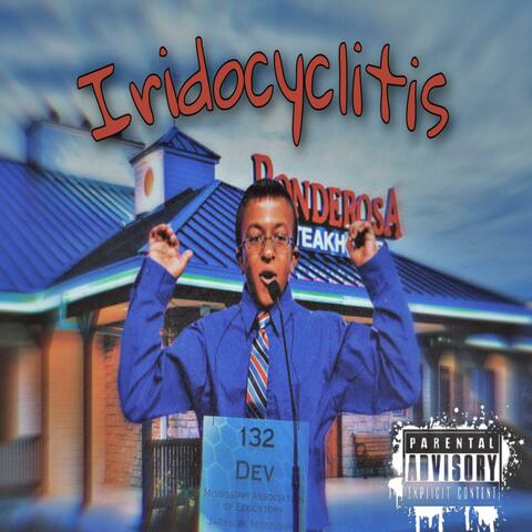 Iridocyclitis