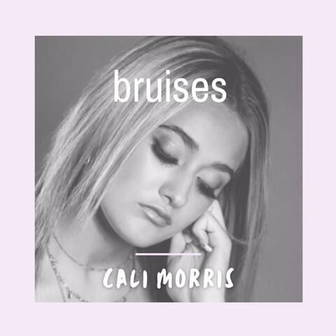 Bruises