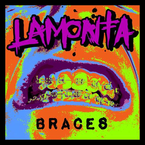 Braces (Digital 7")