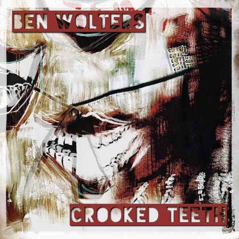 Crooked Teeth
