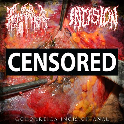Gonorreica Incisión Anal