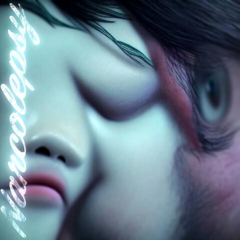 Narcolepsy