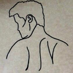 Scars